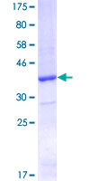 ab159722 on a 12.5% SDS-PAGE stained with Coomassie Blue.