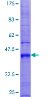 ab159723 on a 12.5% SDS-PAGE stained with Coomassie Blue.