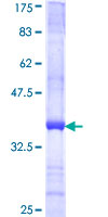 ab160460 on a 12.5% SDS-PAGE stained with Coomassie Blue.