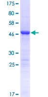 ab163061 on a 12.5% SDS-PAGE stained with Coomassie Blue.