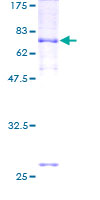 ab161415 on a 12.5% SDS-PAGE stained with Coomassie Blue.