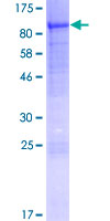 ab166043 on a 12.5% SDS-PAGE stained with Coomassie Blue.
