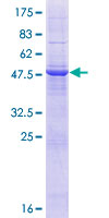 ab163089 on a 12.5% SDS-PAGE stained with Coomassie Blue.