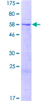 ab164050 on a 12.5% SDS-PAGE stained with Coomassie Blue.