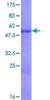 ab161246 on a 12.5% SDS-PAGE stained with Coomassie Blue.
