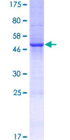 ab165984 on a 12.5% SDS-PAGE stained with Coomassie Blue.