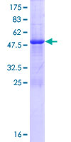 ab162383 on a 12.5% SDS-PAGE stained with Coomassie Blue.