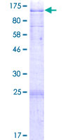 ab160682 on a 12.5% SDS-PAGE stained with Coomassie Blue.