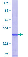 ab164309 on a 12.5% SDS-PAGE stained with Coomassie Blue.