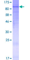 ab164450 on a 12.5% SDS-PAGE stained with Coomassie Blue.