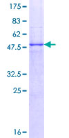ab160184 on a 12.5% SDS-PAGE stained with Coomassie Blue.