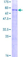 ab164713 on a 12.5% SDS-PAGE stained with Coomassie Blue.