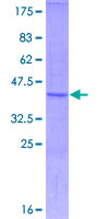 ab164714 on a 12.5% SDS-PAGE stained with Coomassie Blue.