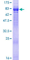 ab153202 on a 12.5% SDS-PAGE stained with Coomassie Blue.