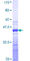 ab159730 on a 12.5% SDS-PAGE stained with Coomassie Blue.