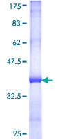 ab153311 on a 12.5% SDS-PAGE stained with Coomassie Blue.