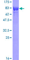 ab160775 on a 12.5% SDS-PAGE stained with Coomassie Blue.