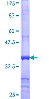 ab153038 on a 12.5% SDS-PAGE stained with Coomassie Blue.