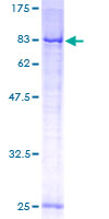 ab153022 on a 12.5% SDS-PAGE stained with Coomassie Blue.