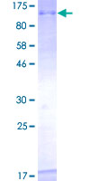 ab160273 on a 12.5% SDS-PAGE stained with Coomassie Blue.