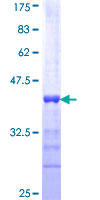 ab161280 on a 12.5% SDS-PAGE stained with Coomassie Blue.