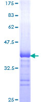 ab159735 on a 12.5% SDS-PAGE stained with Coomassie Blue.
