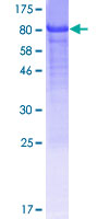 ab165761 on a 12.5% SDS-PAGE stained with Coomassie Blue.