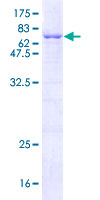 ab163805 on a 12.5% SDS-PAGE stained with Coomassie Blue.