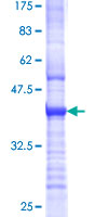 ab163806 on a 12.5% SDS-PAGE stained with Coomassie Blue.