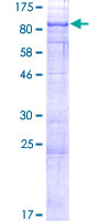 ab165858 on a 12.5% SDS-PAGE stained with Coomassie Blue.