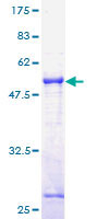 12.5% SDS-PAGE Stained with Coomassie Blue