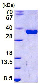 15% SDS-PAGE analysis of 3µg ab156747.