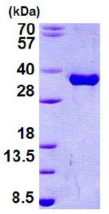15% SDS-PAGE analysis of ab156336 (3µg).