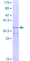 ab162151 on a 12.5% SDS-PAGE stained with Coomassie Blue.