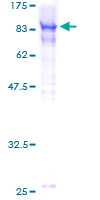 ab160644 on a 12.5% SDS-PAGE stained with Coomassie Blue.