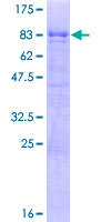 ab164719 on a 12.5% SDS-PAGE stained with Coomassie Blue.