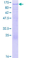 ab160695 on a 12.5% SDS-PAGE stained with Coomassie Blue.