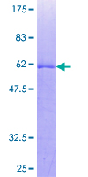 ab162139 on a 12.5% SDS-PAGE stained with Coomassie Blue.