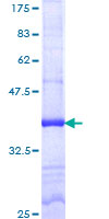 ab162140 on a 12.5% SDS-PAGE stained with Coomassie Blue.