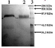 Staining of TPA Tissue Plasminogen Activator protein by 10% SDS-PAGE. Lane 1: ab92679 (3 µg) reduced Lane 2: ab92679 (3 µg) non-reduced Lane 3: Prestained standard