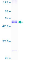 ab159739 on a 12.5% SDS-PAGE stained with Coomassie Blue.