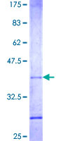 ab159740 on a 12.5% SDS-PAGE stained with Coomassie Blue.