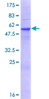 ab163844 on a 12.5% SDS-PAGE stained with Coomassie Blue.