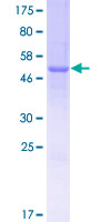 ab161640 on a 12.5% SDS-PAGE stained with Coomassie Blue.