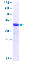 ab153198 on a 12.5% SDS-PAGE stained with Coomassie Blue.