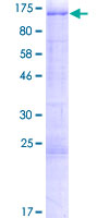 ab153268 on a 12.5% SDS-PAGE stained with Coomassie Blue.