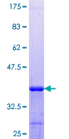 ab153269 on a 12.5% SDS-PAGE stained with Coomassie Blue.