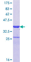 ab164263 on a 12.5% SDS-PAGE stained with Coomassie Blue.