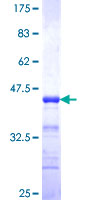 ab152936 on a 12.5% SDS-PAGE stained with Coomassie Blue.
