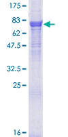 ab164530 on a 12.5% SDS-PAGE stained with Coomassie Blue.
